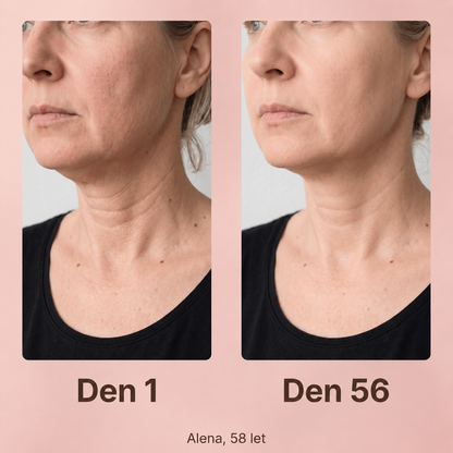 MIVARA™ 3-v-1 EMS lifting přístroj na obličej a krk